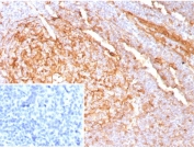 IHC staining of FFPE human tonsil tissue with recombinant Cystatin A antibody (clone CSTA/9087R). Inset: PBS used in place of primary Ab (secondary Ab negative control). HIER: boil tissue sections in pH 9 10mM Tris with 1mM EDTA for 20 min and allow to cool before testing.
