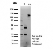 SDS-PAGE analysis of purified, BSA-free IFNG antibody (clone IFNG/9012) as confirmation of integrity and purity.