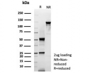 SDS-PAGE analysis of purified, BSA-free KRT6A antibody (clone rKRT6/9402) as confirmation of integrity and purity.