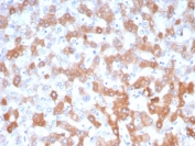 IHC staining of FFPE human liver tissue with APOH antibody (clone APOH/3705). HIER: boil tissue sections in pH 9 10mM Tris with 1mM EDTA for 20 min and allow to cool before testing.