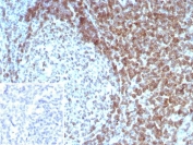 IHC staining of FFPE human tonsil tissue with CD3 delta antibody (clone CD3D/8898). Inset: PBS used in place of primary Ab (secondary Ab negative control). HIER: boil tissue sections in pH 9 10mM Tris with 1mM EDTA for 20 min and allow to cool before testing.