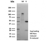 SDS-PAGE analysis of purified, BSA-free recombinant HLA-DP/DQ/DR antibody (HLA-Pan/9268R) as confirmation of integrity and purity.