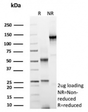 SDS-PAGE analysis of purified, BSA-free recombinant ErbB2 antibody (clone rERBB2/9538) as confirmation of integrity and purity.