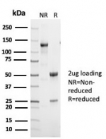 SDS-PAGE analysis of purified, BSA-free p53 antibody (clone TP53/7002R) as confirmation of integrity and purity.