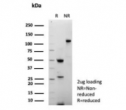 SDS-PAGE analysis of purified, BSA-free recombinant Thymidylate Synthase antibody (clone TYMS/9091R) as confirmation of integrity and purity.
