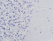 Negative control: IHC staining of FFPE human brain tissue using recombinant Thymidylate Synthase antibody (clone TYMS/9091R). HIER: boil tissue sections in pH 9 10mM Tris with 1mM EDTA for 20 min and allow to cool before testing.