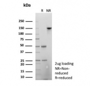 SDS-PAGE analysis of purified, BSA-free Amyloid beta antibody (clone APP/3667) as confirmation of integrity and purity.