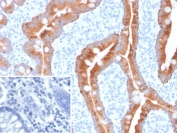 IHC staining of FFPE human colon tissue with recombinant CK8/18 antibody (KRT8.18/6579R). Inset: PBS used in place of primary Ab (secondary Ab negative control). HIER: boil tissue sections in pH 9 10mM Tris with 1mM EDTA for 20 min and allow to cool before testing.