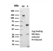 SDS-PAGE analysis of purified recombinant CD5 antibody (clone C5/7020R) as confirmation of integrity and purity.
