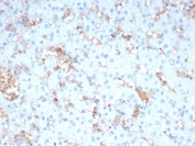 IHC staining of FFPE human liver tissue with Apolipoprotein A4 antibody (clone APOA4/3654). HIER: boil tissue sections in pH 9 10mM Tris with 1mM EDTA for 20 min and allow to cool before testing.