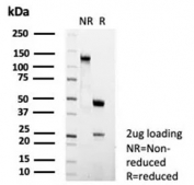 SDS-PAGE analysis of purified, BSA-free FCER2 antibody (clone FCER2/6474R) as confirmation of integrity and purity.