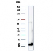 Western blot testing of human kidney tissue lysate using FABP1 antibody (clone FABP1/4462). Predicted molecular weight: ~14 kDa.
