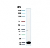 Western blot testing of human kidney tissue lysate using Fatty Acid Binding Protein 1 antibody (clone FABP1/4463). Predicted molecular weight: ~14 kDa.