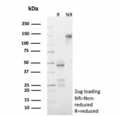 SDS-PAGE analysis of purified, BSA-free recombinant Cathepsin D antibody (clone CTSD/9613R) as confirmation of integrity and purity.