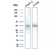 Western blot testing of human 1) HepG2 and 2) A549 cell lysate with NSE gamma antibody (clone ENO2/9044). Predicted molecular weight ~47 kDa.
