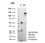 SDS-PAGE analysis of purified, BSA-free recombinant CgA antibody (clone rCHGA/9612) as confirmation of integrity and purity.