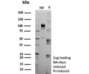 SDS-PAGE analysis of purified, BSA-free recombinant Apolipoprotein J antibody (clone CLU/9192R) as confirmation of integrity and purity.