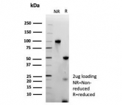 SDS-PAGE analysis of purified, BSA-free recombinant Transcriptional Regulator ERG antibody (clone ERG/9122R) as confirmation of integrity and purity.