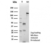 SDS-PAGE analysis of purified, BSA-free Cyclin-dependent kinase 4 antibody (clone CDK4/8896) as confirmation of integrity and purity.