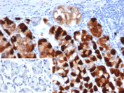 IHC staining of FFPE human stomach tissue with CK-BB antibody (clone CKBB/6871). Inset: PBS used in place of primary Ab (secondary Ab negative control). HIER: boil tissue sections in pH 9 10mM Tris with 1mM EDTA for 20 min and allow to cool before testing.