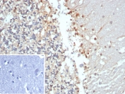 IHC staining of FFPE human brain tissue with recombinant Creatine kinase B antibody (clone CKBB/8306R). Inset: PBS used in place of primary Ab (secondary Ab negative control). HIER: boil tissue sections in pH 9 10mM Tris with 1mM EDTA for 20 min and allow to cool before testing.