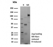 SDS-PAGE analysis of purified, BSA-free recombinant E-Cadherin antibody (clone CDH1/9226R) as confirmation of integrity and purity.