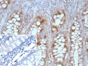 IHC staining of FFPE human colon tissue with recombinant E-Cadherin antibody (clone CDH1/9226R). Inset: PBS used in place of primary Ab (secondary Ab negative control). HIER: boil tissue sections in pH 9 10mM Tris with 1mM EDTA for 20 min and allow to cool before testing.