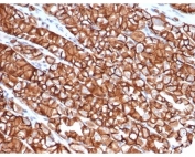 IHC staining of FFPE human stomach tissue with recombinant Cadherin 1 antibody (clone rCDH1/6769). HIER: boil tissue sections in pH 9 10mM Tris with 1mM EDTA for 20 min and allow to cool before testing.