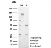 SDS-PAGE analysis of purified, BSA-free recombinant E-Cadherin antibody (clone rCDH1/9615) as confirmation of integrity and purity.