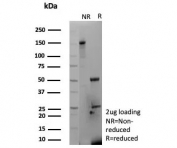 SDS-PAGE analysis of purified, BSA-free MYH7 antibody (clone MYH7/9183) as confirmation of integrity and purity.