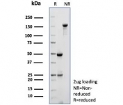 SDS-PAGE analysis of purified, BSA-free Myosin 7 antibody (clone MYH7/9184) as confirmation of integrity and purity.