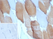IHC staining of FFPE human skeletal muscle tissue with Myosin 7 antibody (clone MYH7/9184). Inset: PBS used in place of primary Ab (secondary Ab negative control). HIER: boil tissue sections in pH 9 10mM Tris with 1mM EDTA for 20 min and allow to cool before testing.