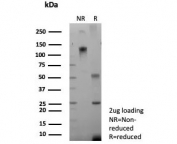 SDS-PAGE analysis of purified, BSA-free recombinant CFTR antibody (clone CFTR/9148R) as confirmation of integrity and purity.