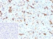 IHC staining of FFPE human pancreas tissue with recombinant CFTR antibody (clone CFTR/9148R). Inset: PBS used in place of primary Ab (secondary Ab negative control). HIER: boil tissue sections in pH 9 10mM Tris with 1mM EDTA for 20 min and allow to cool before testing.