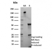 SDS-PAGE analysis of purified, BSA-free recombinant KRT13 antibody (clone rKRT13/9623) as confirmation of integrity and purity.