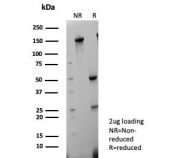 SDS-PAGE analysis of purified, BSA-free CK5/6 antibody (clone KRT5.6/9104) as confirmation of integrity and purity.