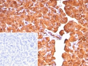 IHC staining of FFPE human pancreas tissue with Carboxypeptidase A1 antibody (clone CPA1/8777). Inset: PBS used in place of primary Ab (secondary Ab negative control). HIER: boil tissue sections in pH 9 10mM Tris with 1mM EDTA for 20 min and allow to cool before testing.