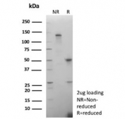SDS-PAGE analysis of purified, BSA-free recombinant Carboxypeptidase A1 antibody (clone CPA1/9622R) as confirmation of integrity and purity.