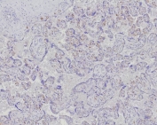 IHC staining of FFPE human placental tissue with Fatty Acid Binding Protein 4 antibody (clone FABP4/9086R). HIER: boil tissue sections in pH 9 10mM Tris with 1mM EDTA for 20 min and allow to cool before testing.