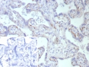 IHC staining of FFPE human placental tissue with Fatty Acid Binding Protein 4 antibody (clone FABP4/9086R). Inset: PBS used in place of primary Ab (secondary Ab negative control). HIER: boil tissue sections in pH 9 10mM Tris with 1mM EDTA for 20 min and allow to cool before testing.