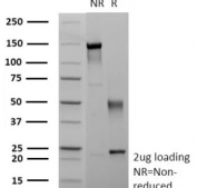 SDS-PAGE analysis of purified, BSA-free recombinant MUC1 antibody (clone r115D8) as confirmation of integrity and purity.