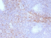 IHC staining of FFPE human tonsil tissue with CD44v6 antibody (clone HCAM/6779). HIER: boil tissue sections in pH 9 10mM Tris with 1mM EDTA for 20 min and allow to cool before testing.