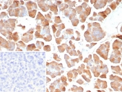 IHC staining of FFPE human pancreas tissue with Pancreatic lipase antibody (clone PNLIP/8913). Inset: PBS used in place of primary Ab (secondary Ab negative control). HIER: boil tissue sections in pH 9 10mM Tris with 1mM EDTA for 20 min and allow to cool before testing.