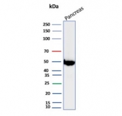 Western blot testing of human pancreas tissue lysate with PNLIP antibody. Predicted molecular weight ~51 kDa.