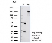 SDS-PAGE analysis of purified, BSA-free Pancreatic lipase antibody (clone PNLIP/9040) as confirmation of integrity and purity.