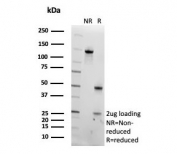 SDS-PAGE analysis of purified, BSA-free Pancreatic triacylglycerol lipase antibody (clone PNLIP/9042) as confirmation of integrity and purity.