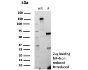 SDS-PAGE analysis of purified, BSA-free recombinant CD31 antibody (clone C31/9224R) as confirmation of integrity and purity.