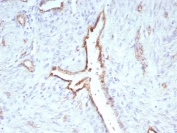 IHC staining of FFPE human uterus tissue with recombinant CD31 antibody (clone C31/9224R). HIER: boil tissue sections in pH 9 10mM Tris with 1mM EDTA for 20 min and allow to cool before testing.