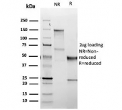 SDS-PAGE analysis of purified recombinant TSH Receptor antibody (clone TSHRB/1607R) as confirmation of integrity and purity.