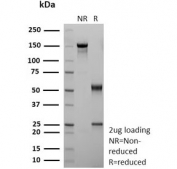 SDS-PAGE analysis of purified, BSA-free recombinant CD36 antibody (clone rGPIIIb/9240) as confirmation of integrity and purity.